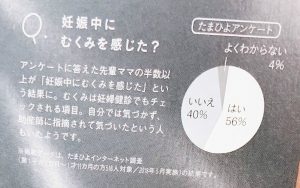 妊娠中のむくみアンケート