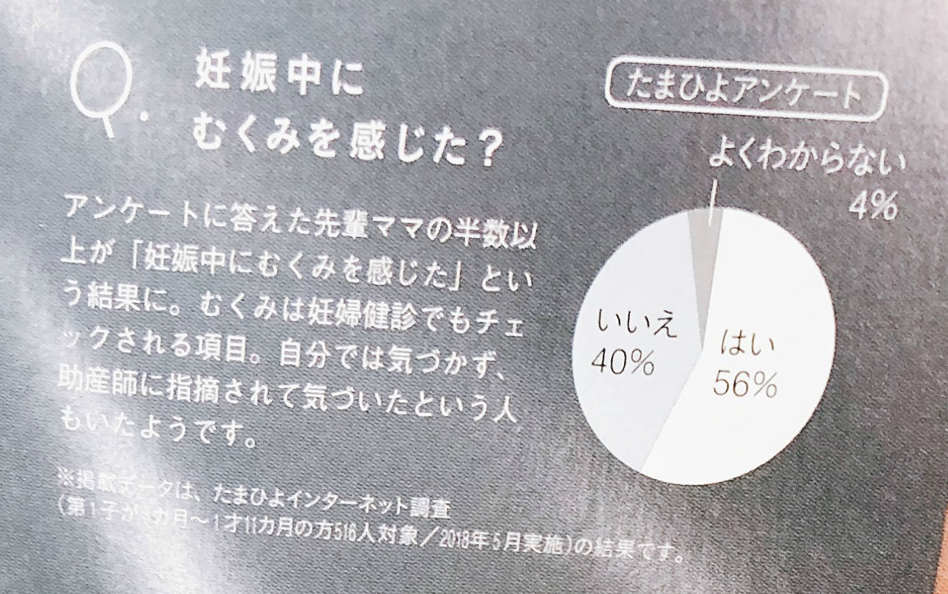 妊娠中のむくみアンケート