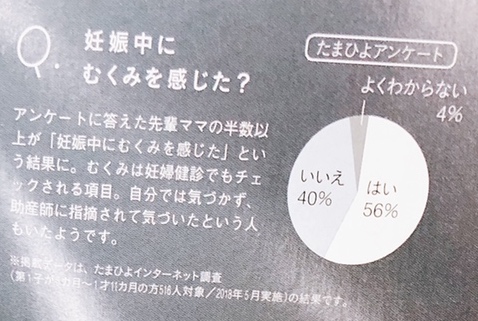 妊娠中のむくみで悩む人は２人に１人アンケート