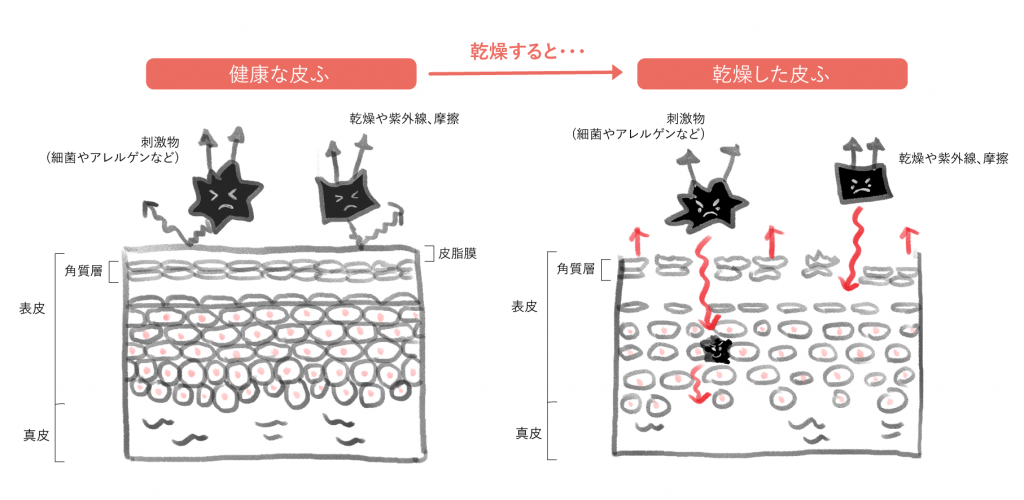肌荒れ,肌の乾燥